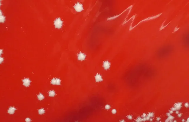 Star shaped candida albicans in Blood Agar - Star-shaped colonies ofCandida albicansin blood agar.