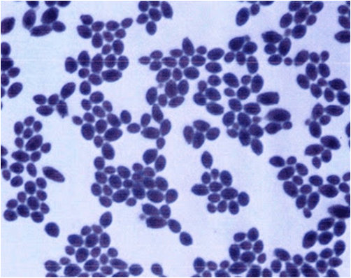 Candida albicans in Gram Staining - Candida albicansin Gram Staining