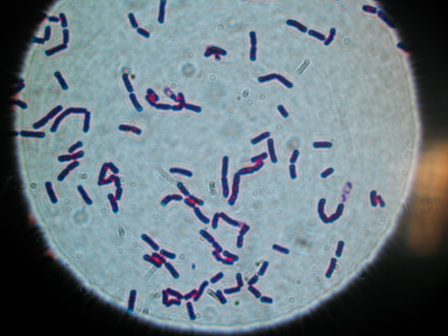 Bacillus cereus Gram stain - Bacillus cereus(Source: BCCDC Labs)