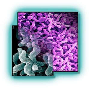 Campylobacter jejuni: Curve, S shaped gram negative bacteria - Campylobacter jejuni: Curve, S shaped gram negative bacteria