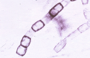 coccidioides - Coccidioides immitis– arthroconidia Dr Arthur DiSalvo
