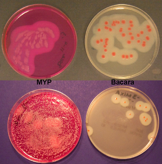 - Colonies of B. cereus on MYP and Bacara agar medium (Imagesource)