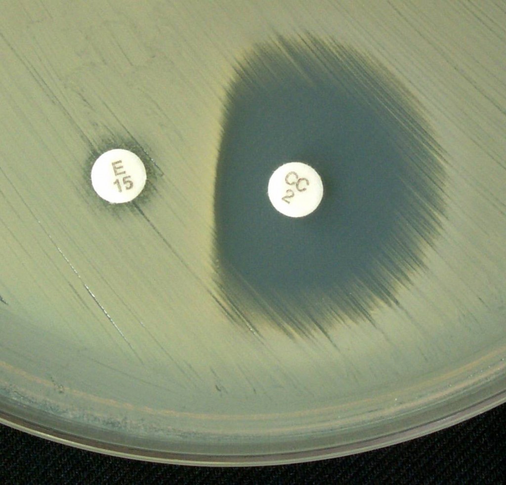 Inducible Clindamycin Resistance - Positive Inducible Clindamycin Resistance (D-test) test