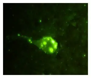 Fluorescent antibody technique (FAT) on human brain smear positive for rabies
