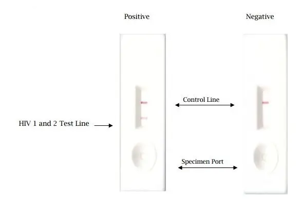 Rapid tests for the diagnosis of HIV infection