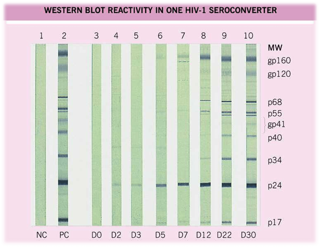 Western Blot Test for HIV diagnosis 