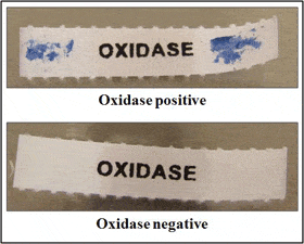 Oxidase test result