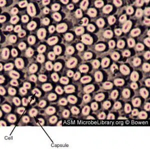 Bacterial Capsule Image source: ASM