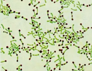 Metachromatic granules of Corynebacterium spp
