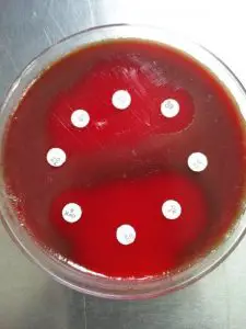 Antimicrobial sensitivity testing of Streptococcus pneumoniae 
