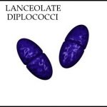 Lanceolate diplococci. Image source: microbiologyinpictures.com