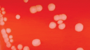N. meningitidis on blood agar plate 