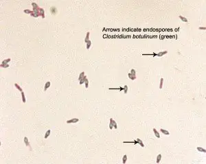 Spore of Clostridium botulinum Source: ASM