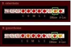 Dnase Test: M. catarrhalis (+ve) and N.gonorrhoeae (-ve) 