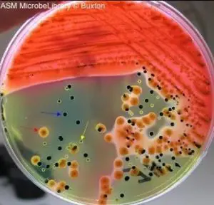 Hektoen enteric agar colonies