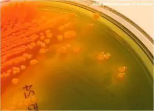  yellow-orange colonies of Proteus vulgaris in Hektoen Enteric Agar
