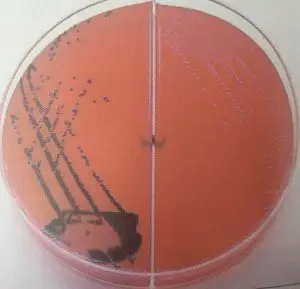 XLD Cultures: Left: Red-pink black centered colonies of Salmonella typhimurium  Right: Red-pink Shigella colonies