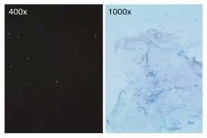 Comparison of ZN Staining an Flurochrome Staining
