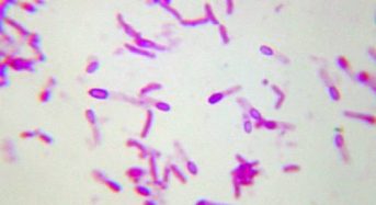 bacillus subtilis endospore stain