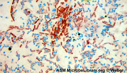 bacillus cereus_endospore stain