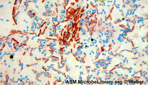 staphylococcus epidermidis endospore stain