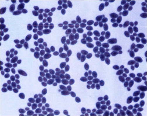 Candida albicans in Gram Staining 