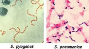 Streptococcus spp   (S. pyogenes and S. pneumoniae)