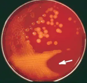 Blood agar showing β-hemolysis 