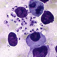 Amastigote form of Leishmania (LD Bodies)