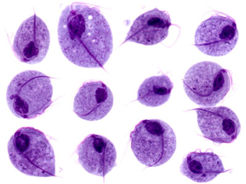 Lab Diagnosis Of Trichomonas Vaginalis Infections Microbe Online 4762