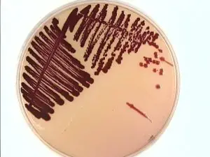 Red colored colonies of Serratia marcescens in MacConkey Agar (Source University of Maryland)