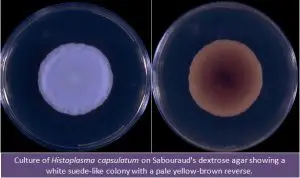 Histoplasma capsulatum culture in SDA Source:http://www.mycology.adelaide.edu.au/