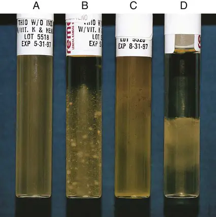 Growth Characteristics of Various Bacteria in tholgycollate broth