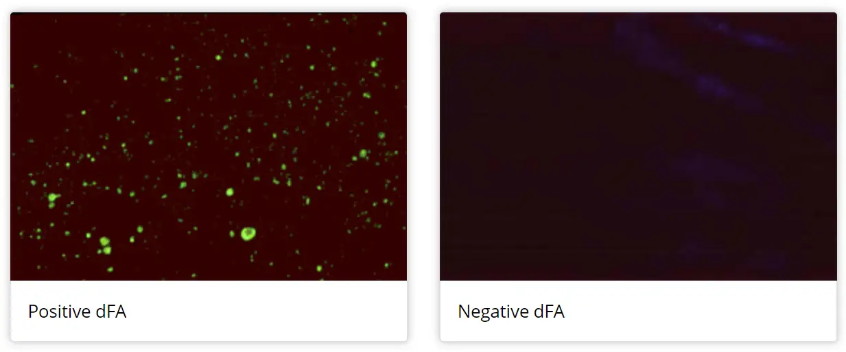 Direct Fluorescent Antibody Dfa Test Microbe Online