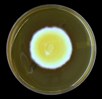  - Colonies ofBlastomyces dermatitidisin SDA after 7 days of growth  (Image source:http://thunderhouse4-yuri.blogspot.com/)