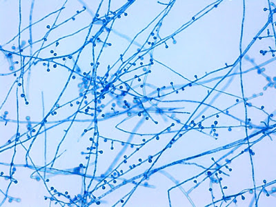  - “lollipop-like” conidiophore-conidia structures ofB. dermatitidis(Image source:http://thunderhouse4-yuri.blogspot.com/)