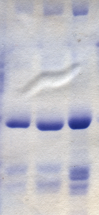 Polyacrylamide gel after staining with Coomassie blue - Polyacrylamide gel after staining with Coomassie blue