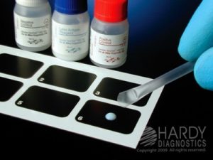 ASO Latex test - ASO Latex test