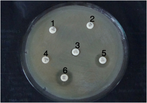  - Testing to find out which antibiotic will kill the organism