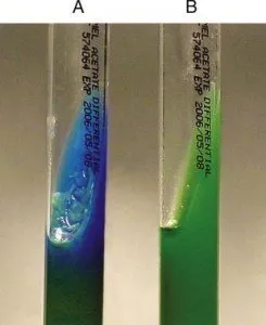 Acetate Utilization Test A. Positive B. Negative - Acetate Utilization TestA. PositiveB. Negative