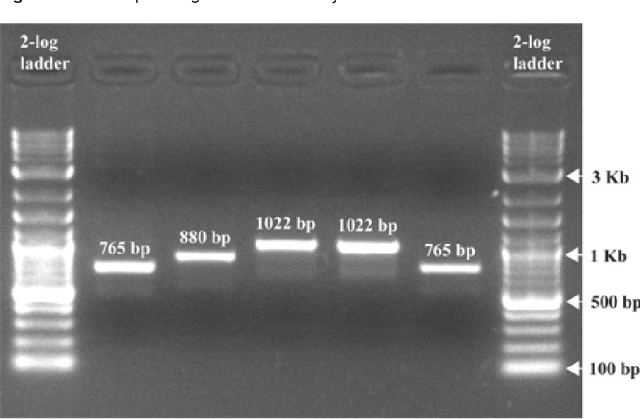 - An image of a gel post electrophoresis (Image Source: Ref-1)