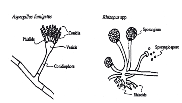  - Aspergillus fumigatusandRhizopus