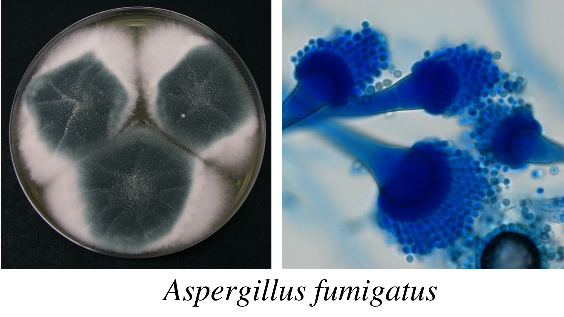 Aspergillus fumigatus - Aspergillus fumigatus