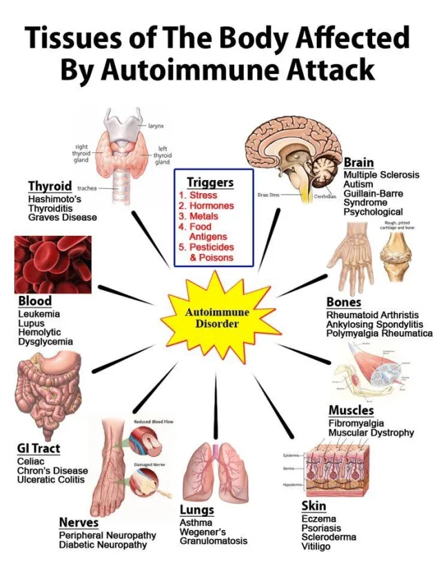 Tissues affected by autoimmune attack - Tissues of the body affected by autoimmune attack