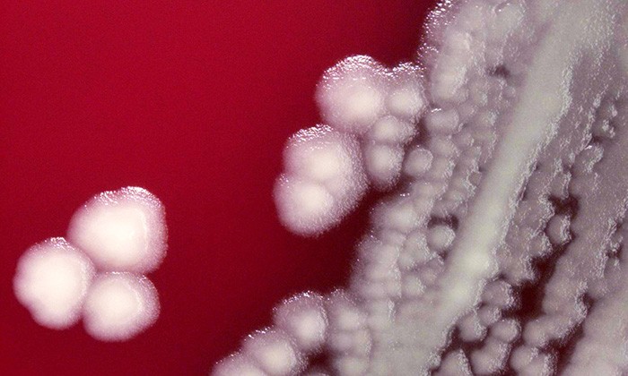Bacillus anthracis colonies in Blood Agar - Bacilus anthraciscolonies inBlood Agarat 10x magnification.Photo credit: Todd Parker/CDC.