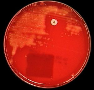 Bacitracin (A disk) test for identifying Streptococcus pyogenes - Image 2:Bacitracin (A disk) test for identifyingStreptococcus pyogenes.