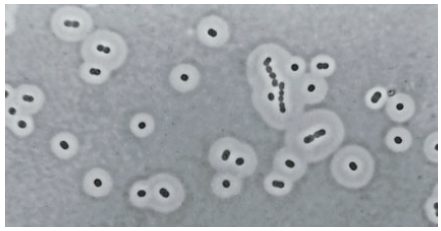 Capsules of Acinetobacter species as seen under phase-contrast microscopy after negative staining - Capsules ofAcinetobacterspecies as seen under phase-contrast microscopy after negative staining (Image source: Elliot Juni)