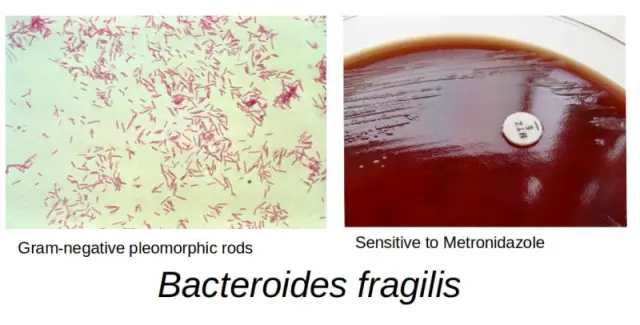 Bacteroides fragilis