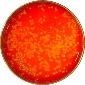 Beta hemolysis of Listeria monocytogenes - Beta-hemolytic colonies ofL. monocytogenes