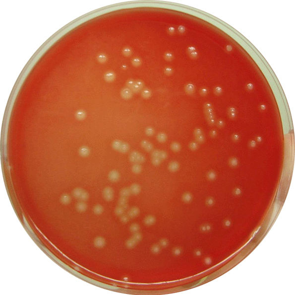Beta-hemolytic colonies of Streptococcus agalactiae - Beta-hemolytic colonies ofS. agalactiae(Image source: wikimedia.org)